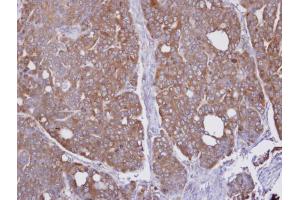 Immunohistochemistry (IHC) image for anti-Hydroxyacylglutathione Hydrolase (HAGH) antibody (ABIN2856165)