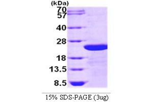 SDS-PAGE (SDS) image for Transforming Growth Factor, beta-Induced, 68kDa (TGFBI) (AA 502-683) protein (ABIN666732) (TGFBI Protein (AA 502-683))