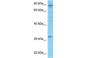 Host:  Rabbit  Target Name:  LRC52  Sample Type:  ACHN Whole Cell lysates  Antibody Dilution:  1. (LRRC52 抗体  (Middle Region))