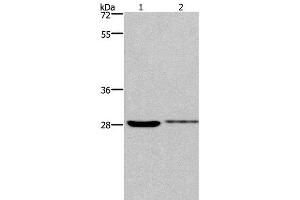 Western Blot analysis of 231 and Hela cell using CDK1 Polyclonal Antibody at dilution of 1:300 (CDK1 抗体)