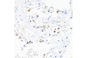Immunohistochemistry (IHC) image for anti-Cathelicidin Antimicrobial Peptide (CAMP) (AA 31-170) antibody (ABIN3022306)