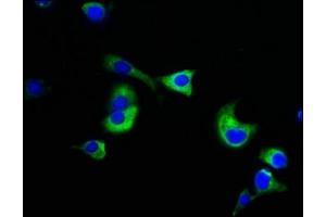 Immunofluorescence staining of MCF-7 cells with ABIN7161807 at 1:133, counter-stained with DAPI. (NUMA1 抗体  (AA 627-870))