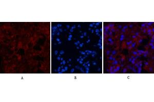 Immunofluorescence analysis of human appendix tissue. (MICU1 抗体)