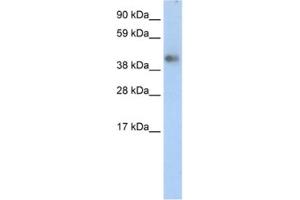 Western Blotting (WB) image for anti-Zinc Finger Protein 620 (ZNF620) antibody (ABIN2460288) (ZNF620 抗体)