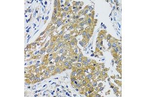 Immunohistochemistry (Paraffin-embedded Sections) (IHC (p)) image for anti-Glutamic-Oxaloacetic Transaminase 1, Soluble (Aspartate Aminotransferase 1) (GOT1) (AA 244-413) antibody (ABIN6141283)