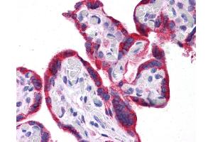 Immunohistochemistry (IHC) image for anti-Leptin (LEP) (N-Term) antibody (ABIN2776943) (Leptin 抗体  (N-Term))