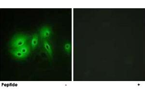 Immunofluorescence analysis of A-549 cells, using ADCY8 polyclonal antibody . (ADCY8 抗体)