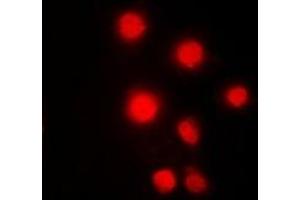 Immunofluorescent analysis of HMGB2 staining in Hela cells.