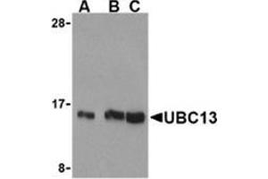 Western blot analysis of UBC13 in human small intestine cell lysates with this product at (A) 0. (UBE2N 抗体  (C-Term))