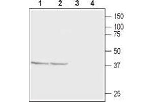 Western blot analysis of rat (lanes 1 and 3) and mouse (lanes 2 and 4) brain membranes: - 1,2. (CABP1 抗体  (C-Term, Intracellular))