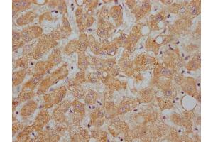 IHC image of ABIN7144415 diluted at 1:200 and staining in paraffin-embedded human liver tissue performed on a Leica BondTM system. (APOC1 抗体  (AA 35-48))