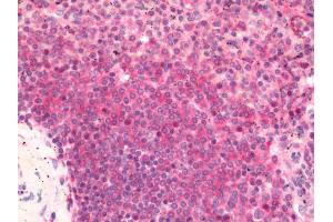 Immunohistochemistry (Paraffin-embedded Sections) (IHC (p)) image for anti-Transient Receptor Potential Cation Channel, Subfamily M, Member 2 (TRPM2) (AA 1200-1250) antibody (ABIN2575864)