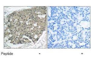 Image no. 1 for anti-V-Akt Murine Thymoma Viral Oncogene Homolog 1 (AKT1) (Thr308) antibody (ABIN197195) (AKT1 抗体  (Thr308))