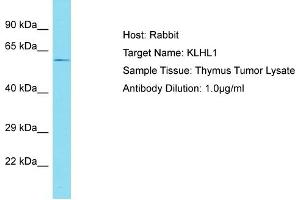 Host: Rabbit Target Name: KLHL1 Sample Tissue: Human Thymus Tumor Antibody Dilution: 1ug/ml (KLHL1 抗体  (C-Term))