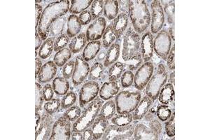 Immunohistochemical staining of human kidney with SLC7A4 polyclonal antibody  shows distinct cytoplasmic positivity with a granular pattern in tubular cells. (SLC7A4 抗体)