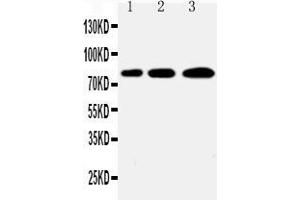 Western blot analysis of PLK2/Snk using anti- PLK2/Snk antibody . (PLK2 抗体  (C-Term))