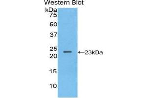 Detection of Recombinant NME3, Human using Polyclonal Antibody to Non Metastatic Cells 3, Protein NM23A Expressed In (NME3) (NME3 抗体  (AA 1-168))