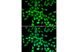 Immunofluorescence (IF) image for anti-serpin Peptidase Inhibitor, Clade A (Alpha-1 Antiproteinase, Antitrypsin), Member 10 (SERPINA10) (AA 165-444) antibody (ABIN1682657)