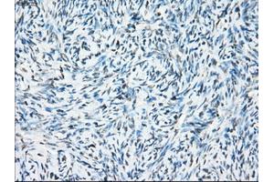 Immunohistochemical staining of paraffin-embedded colon tissue using anti-CRYABmouse monoclonal antibody. (CRYAB 抗体)