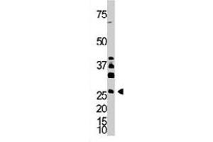 The DKK4 polyclonal antibody  is used in Western blot to detect DKK4 in A-375 cell lysate. (DKK4 抗体  (AA 162-189))