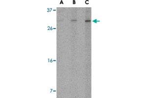 Western blot analysis of ORAI2 in Jurkat cell lysate with ORAI2 polyclonal antibody  at (A) 1, (B) 2 and (C) 4 ug/mL . (ORAI2 抗体  (C-Term))