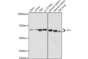 Western blot analysis of extracts of various cell lines, using YY1 antibody (ABIN6128933, ABIN6150354, ABIN6150356 and ABIN6216742) at 1:1000 dilution. (YY1 抗体  (AA 1-200))