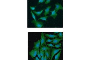 ICC/IF analysis of TBCA in A549 cells line, stained with DAPI (Blue) for nucleus staining and monoclonal anti-human TBCA antibody (1:100) with goat anti-mouse IgG-Alexa fluor 488 conjugate (Green). (TBCA 抗体  (AA 1-108))