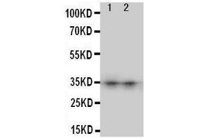 Anti-Aquaporin 8 antibody, Western blotting Lane 1: SW620 Cell Lysate Lane 2: COLO320 Cell Lysate (Aquaporin 8 抗体  (N-Term))