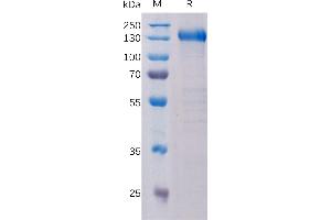 SDS-PAGE (SDS) image for PTK7 Protein tyrosine Kinase 7 (PTK7) (AA 31-704) protein (Fc Tag) (ABIN7092672)