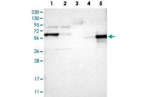 Western Blot analysis of Lane 1: RT-4 cell, Lane 2: U-251 MG sp cell, Lane 3: human plasma tissue (IgG/HSA depleted), Lane 4: human liver tissue and Lane 5: human tonsil tissue lysates with ICA1 polyclonal antibody . (ICA1 抗体)