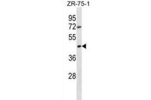 Western Blotting (WB) image for anti-Olfactory Receptor, Family 2, Subfamily T, Member 6 (OR2T6) antibody (ABIN2998458) (OR2T6 抗体)