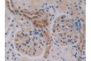 Detection of NOS2 in Rat Kidney Tissue using Polyclonal Antibody to Nitric Oxide Synthase 2, Inducible (NOS2) (NOS2 抗体  (AA 518-694))