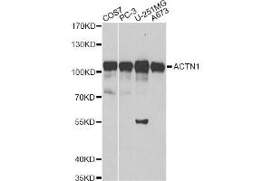 Western blot analysis of extracts of various cell lines, using ACTN1 antibody. (ACTN1 抗体)