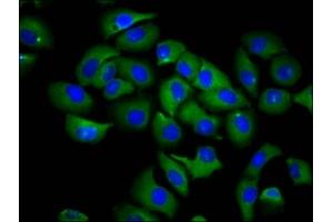 Immunofluorescence staining of A549 cells with ABIN7168014 at 1:66, counter-stained with DAPI. (RND1 抗体  (AA 1-106))