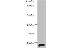 Western blot All lanes: TNNC2 antibody at 10 μg/mL + Mouse skeletal muscle tissue Secondary Goat polyclonal to rabbit IgG at 1/10000 dilution Predicted band size: 18 kDa Observed band size: 18 kDa (TNNC2 抗体  (AA 1-160))