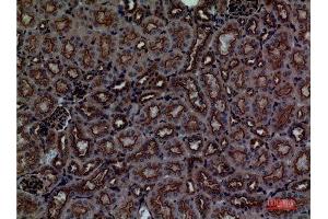 Immunohistochemistry (IHC) image for anti-CUB Domain Containing Protein 1 (CDCP1) (Internal Region) antibody (ABIN3187811)