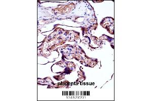 Immunohistochemistry (IHC) image for anti-Neural Precursor Cell Expressed, Developmentally Down-Regulated 9 (NEDD9) (AA 335-363) antibody (ABIN5534368)