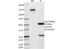 SDS-PAGE Analysis Purified Creatine Kinase-BB (CKBB) Mouse Monoclonal Antibody (2ba6). (CKB 抗体)
