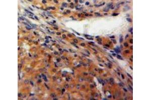IHC-P analysis of Ovary tissue, with DAB staining. (FBLN2 抗体  (AA 858-1069))