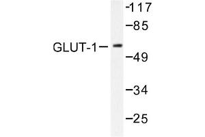 Image no. 1 for anti-Solute Carrier Family 2 (Facilitated Glucose Transporter), Member 1 (SLC2A1) antibody (ABIN265442) (GLUT1 抗体)