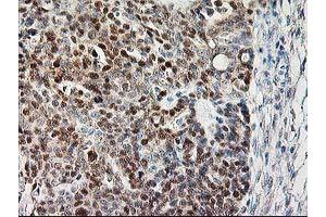 Image no. 2 for anti-Calpain 9 (CAPN9) antibody (ABIN1497092) (Calpain 9 抗体)