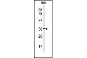 Western blot analysis of CTDSPL Antibody (N-term) in Hela cell line lysates (35ug/lane). (CTDSPL 抗体  (N-Term))