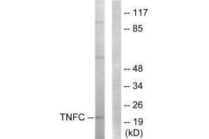 Western blot analysis of extracts from HepG2 cells, using TNFC antibody. (LTB 抗体  (C-Term))