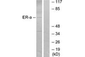 Western blot analysis of extracts from MCF7 cells, treated with Estradiol, using Estrogen Receptor-alpha (Ab-106) Antibody. (Estrogen Receptor alpha 抗体  (AA 71-120))
