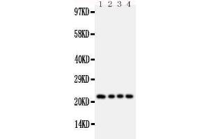 Anti-FGF22 antibody, Western blotting Lane 1: Rat Ovary Tissue Lysate Lane 2: Rat Ovary Tissue Lysate Lane 3: Rat Testis Tissue Lysate Lane 4: Rat Testis Tissue Lysate (FGF22 抗体  (Middle Region))