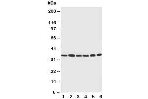 Western blot testing of Cdk4 antibody and Lane 1:  rat thymus (CDK4 抗体  (C-Term))