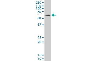 SOX9 monoclonal antibody (M02), clone 3C10 Western Blot analysis of SOX9 expression in HepG2 . (SOX9 抗体  (AA 400-509))