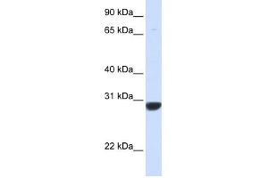 PNPO antibody used at 1 ug/ml to detect target protein. (PNPO 抗体  (N-Term))