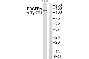 Western blot analysis of extracts from HepG2 cells, using PDGFRb (Phospho-Tyr771) antibody. (ARFGAP3 抗体  (Internal Region))