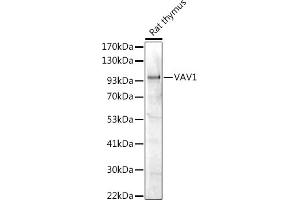 Western blot analysis of extracts of Rat thymus, using V antibody (ABIN7271302) at 1:1000 dilution. (VAV1 抗体  (AA 100-200))